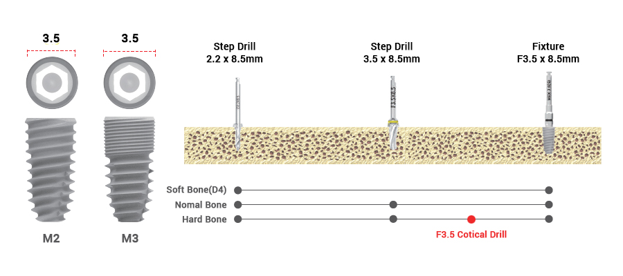 drilling sequence 3.5