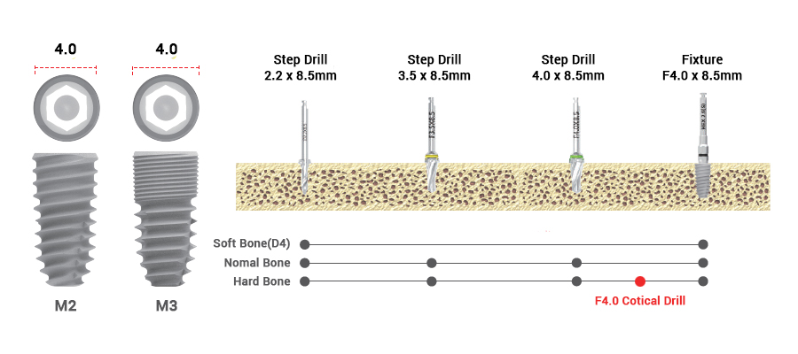 drilling sequence 3.5