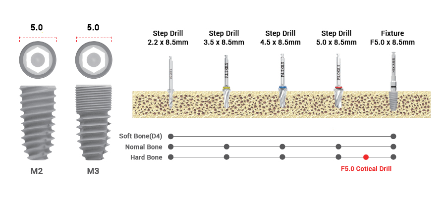 drilling sequence 3.5