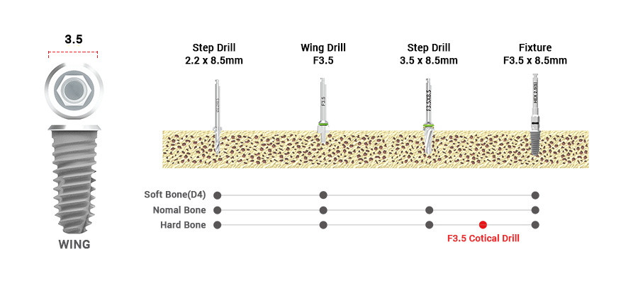 drilling sequence 3.5